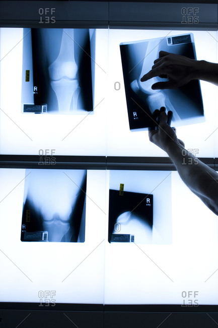 Male hands holding xrays - Offset