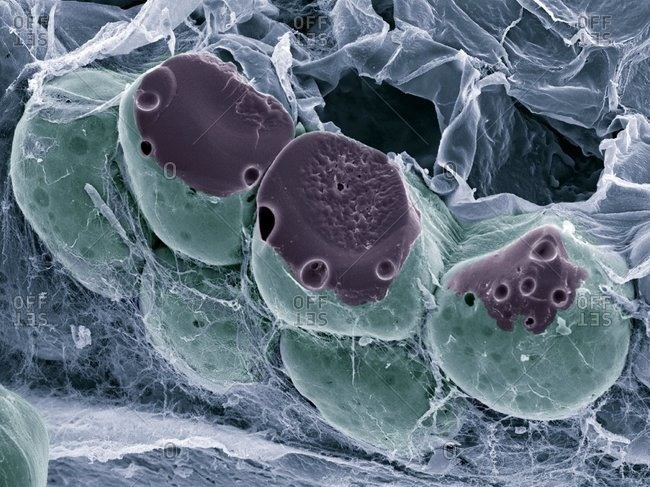 Magnification view of fat (adipose) tissue under a Color scanning electron micrograph