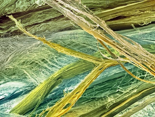 Tendon fibers under a Color scanning electron micrograph