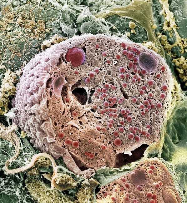 Color Scanning Electron Micrograph Of An Acinar Exocrine Pancreatic Cell Acinar Cells Produce And Excrete Digestive Enzymes To The Small Intestine Via The Pancreatic Ducts Stock Photo Offset