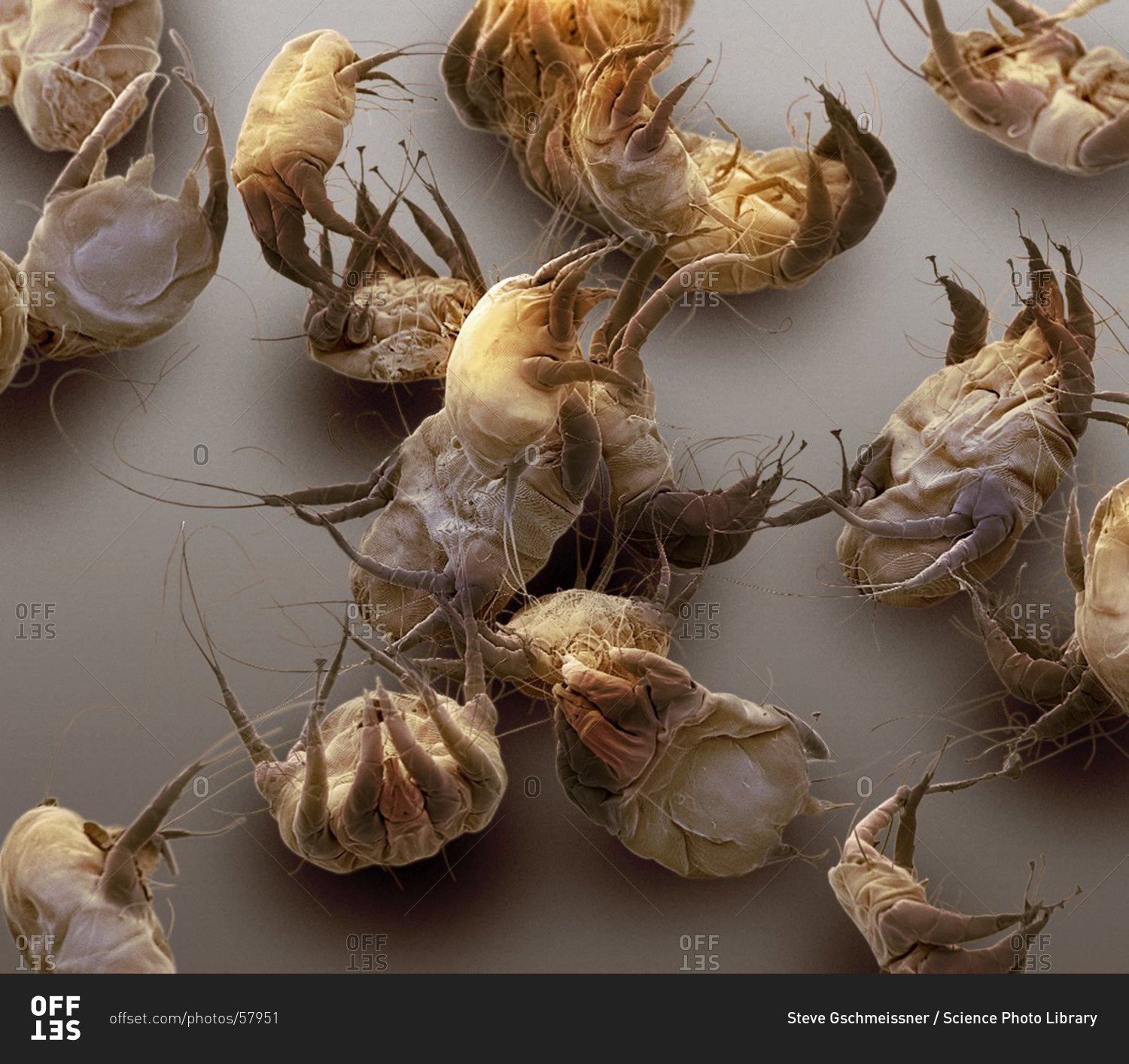 Color scanning electron micrograph of house dust mites (Dermatophagoides pteronyssinus).