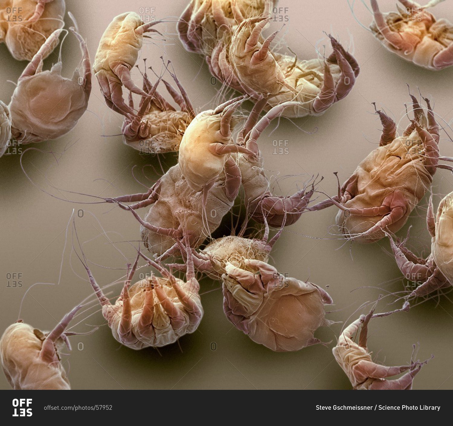 Color scanning electron micrograph of house dust mites (Dermatophagoides pteronyssinus).