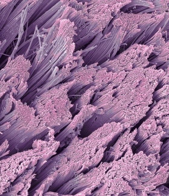 Fractured tendon under a Color scanning electron micrograph showing the collagen fibers.