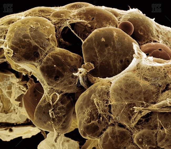 Magnification view of fat (adipose) tissue under a Color scanning electron micrograph