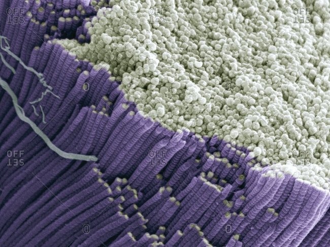 Magnification view of a tendon under a Color scanning electron micrograph showing bundles of collagen fibers