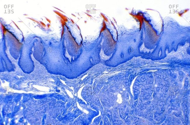 Light micrograph of a longitudinal section through filiform papillae on the tongue surface. Papillae are the tiny projections that give the tongue its rough texture.