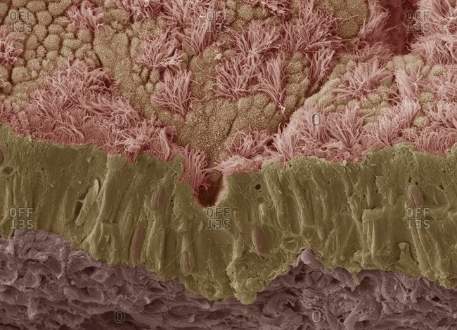 Color scanning electron micrograph of a fractured mucous membrane of the trachea (wind pipe), showing the epithelium and underlying connective tissue.