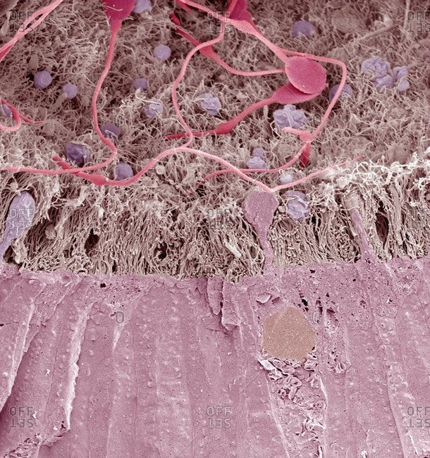 Epididymis under a Color scanning electron micrograph of a freeze fracture through the epididymis.