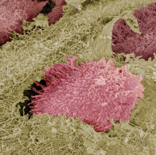 Hyaline cartilage under a Color scanning electron micrograph of a freeze-fractured section through hyaline cartilage, a semi-rigid connective tissue, from the trachea (windpipe).