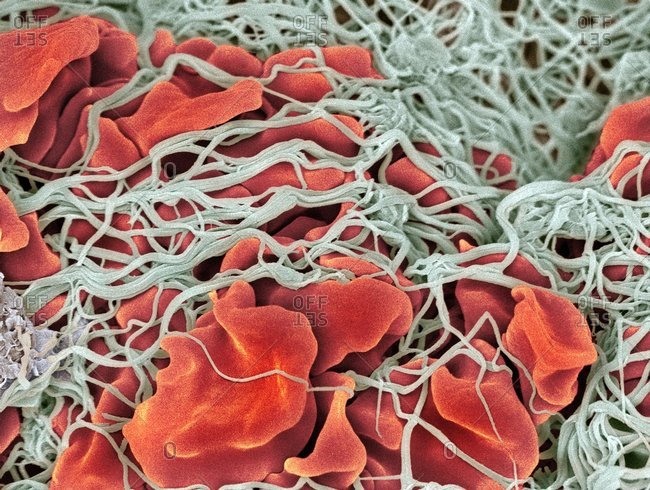 fibrin blood clot