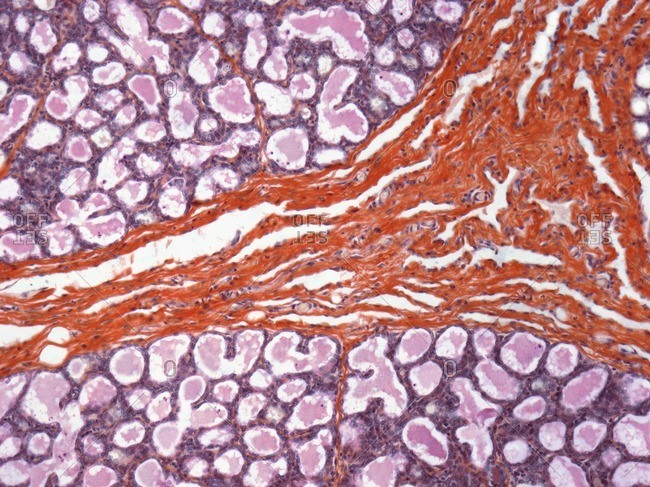 Lactating breast tissue under a light micrograph.