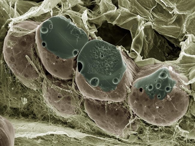 Magnification view of fat (adipose) tissue under a Color scanning electron micrograph