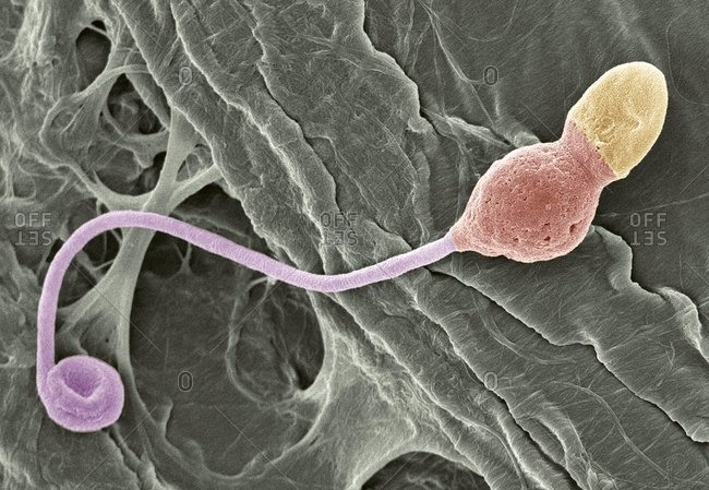 magnification-view-of-a-deformed-sperm-cell-under-a-color-scanning