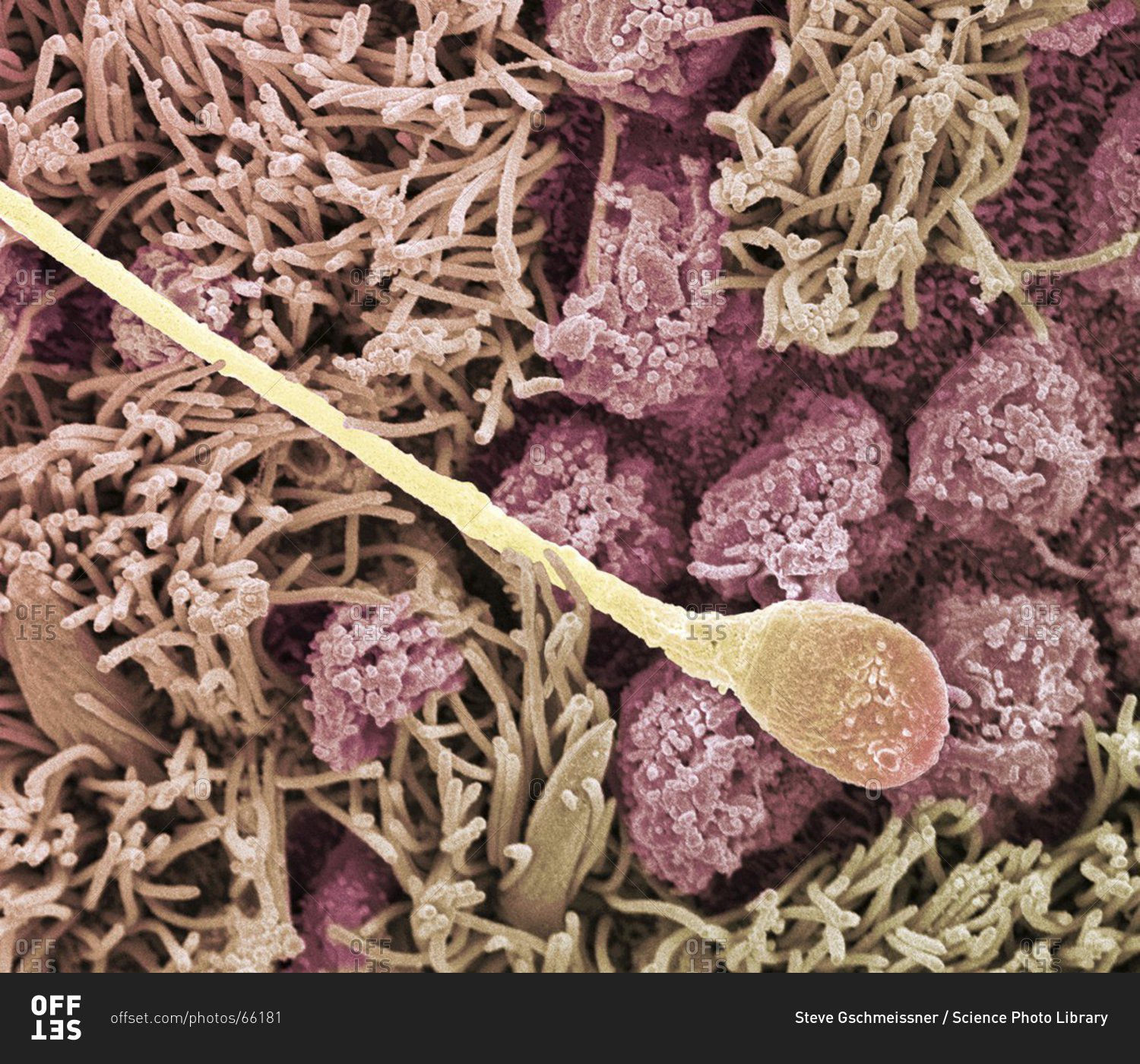 human cell under electron microscope