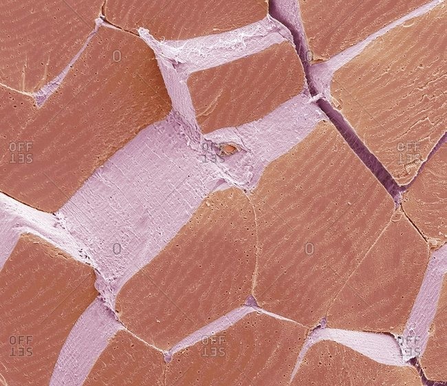 Color scanning electron micrograph of a section through fractured skeletal muscle to show large muscle bundles, or fascicles (red).