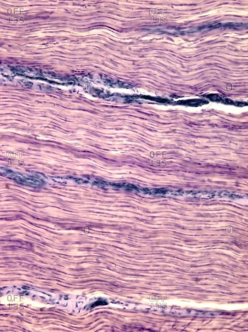 Light micrograph of a transverse section through a tendon showing the parallel collagen fibres.