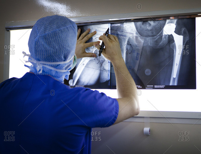 Orthopaedic surgeon marking xrays Offset stock photo OFFSET