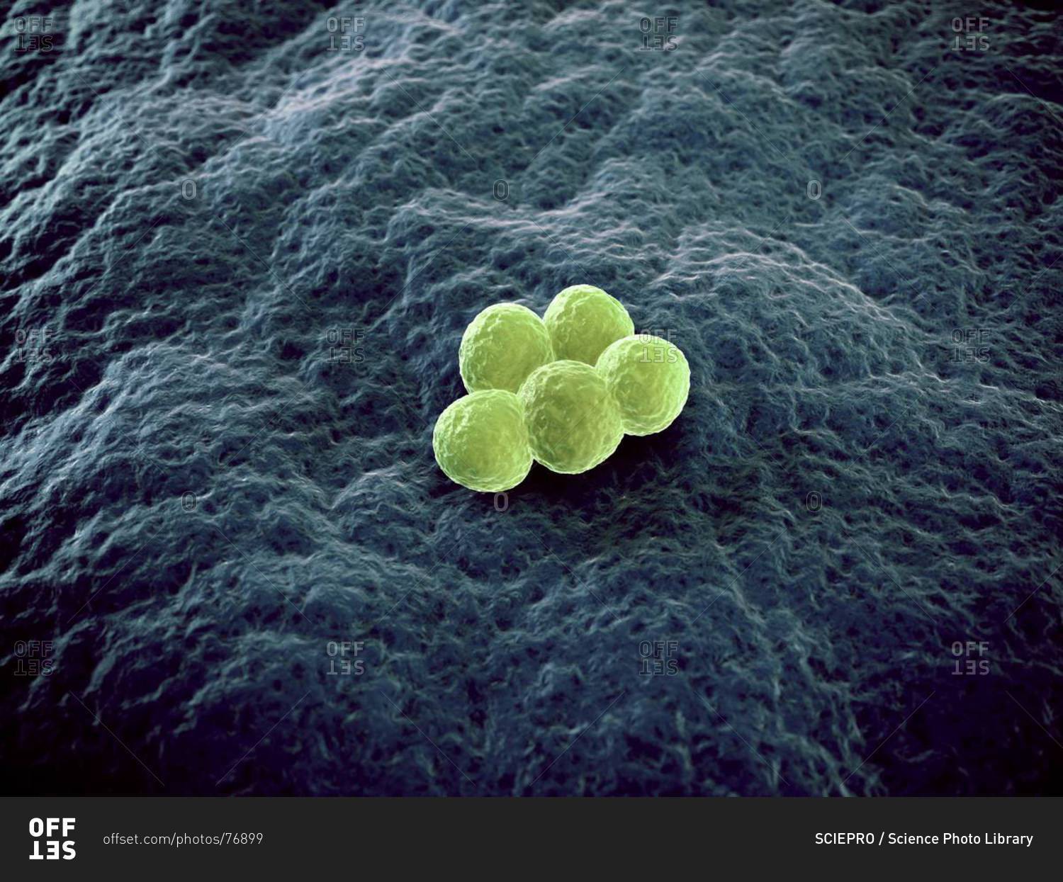 Macro View Of MRSA (Methicillin-Resistant Staphylococcus Aureus ...