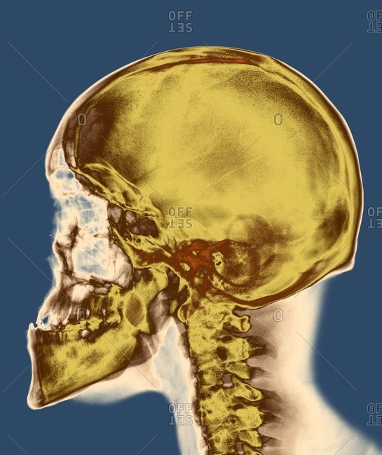 x ray skull side