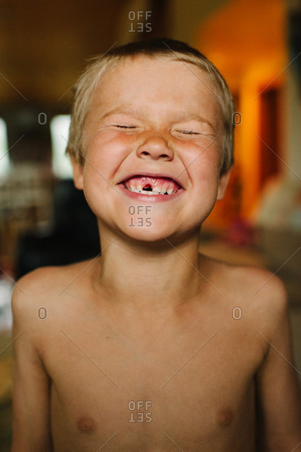 Boy showing off missing tooth