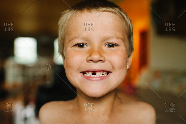 Boy happily showing off missing tooth