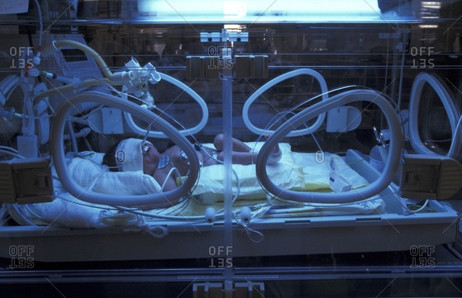 Premature infant in an incubator with UV lamp.