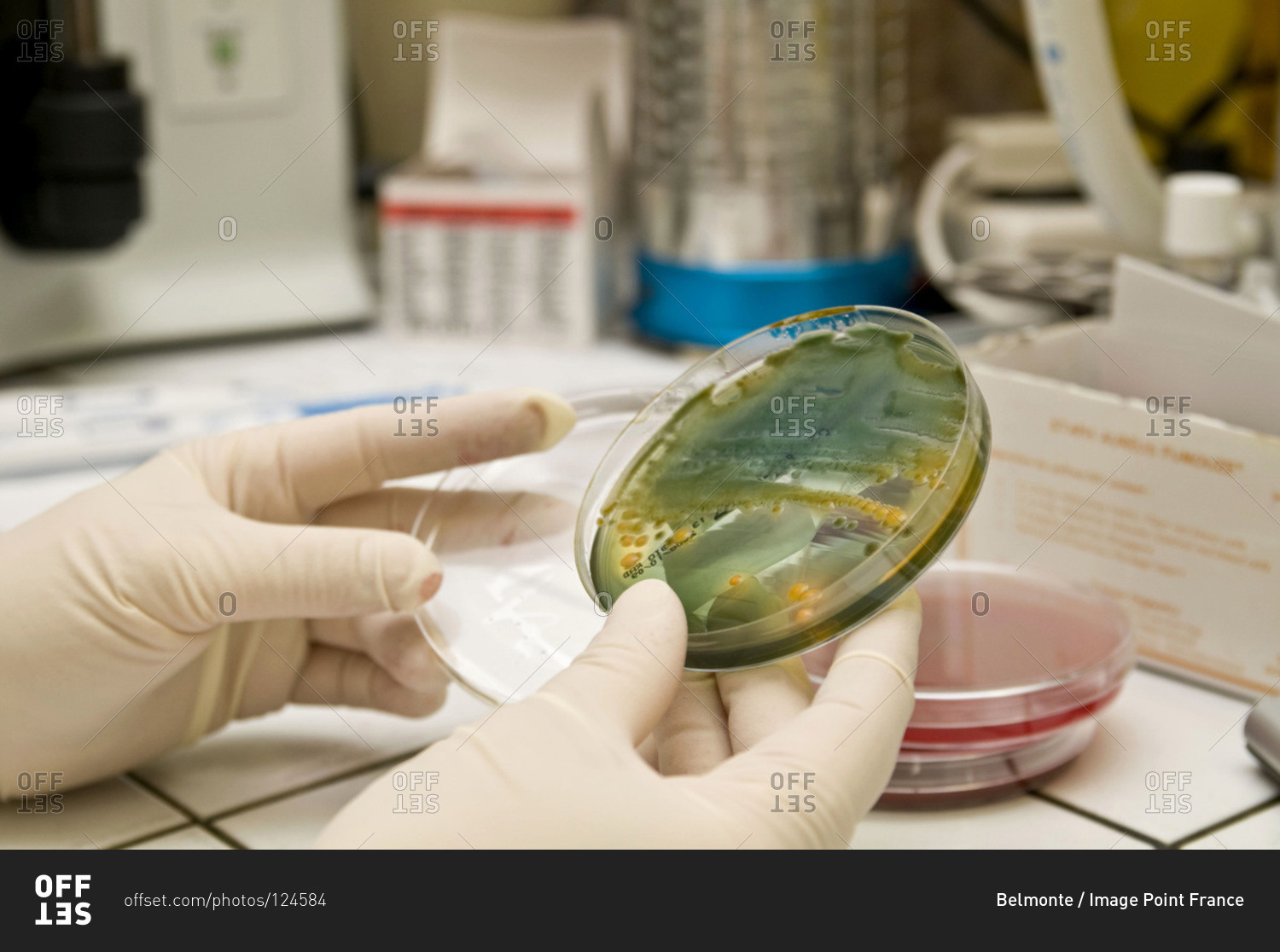 Petri dish of germs in the urine. stock photo OFFSET