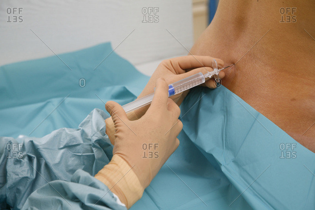 An anesthesiologist placing an epidural injection.