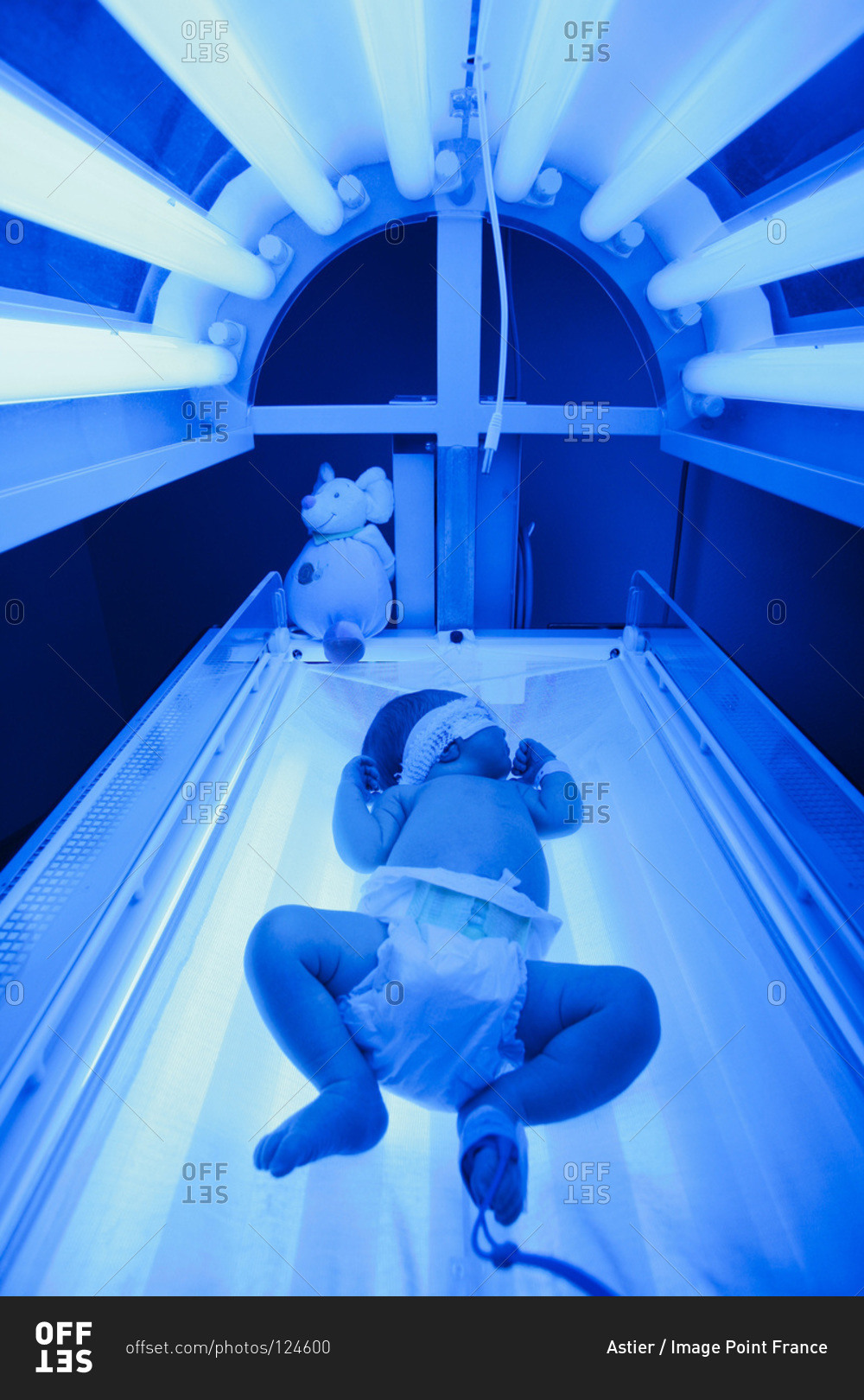 Phototherapy for a newborn baby with a high rate of bilirubine (jaundice).