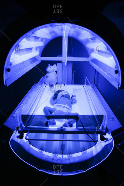 Phototherapy for a newborn baby with a high rate of bilirubine (jaundice).
