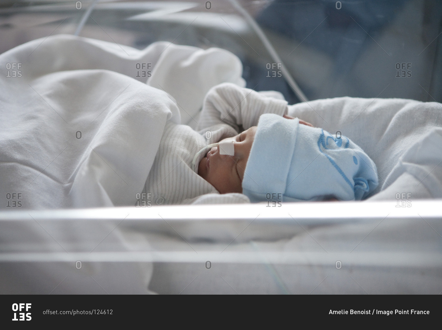 Close up view of a premature baby sleeping