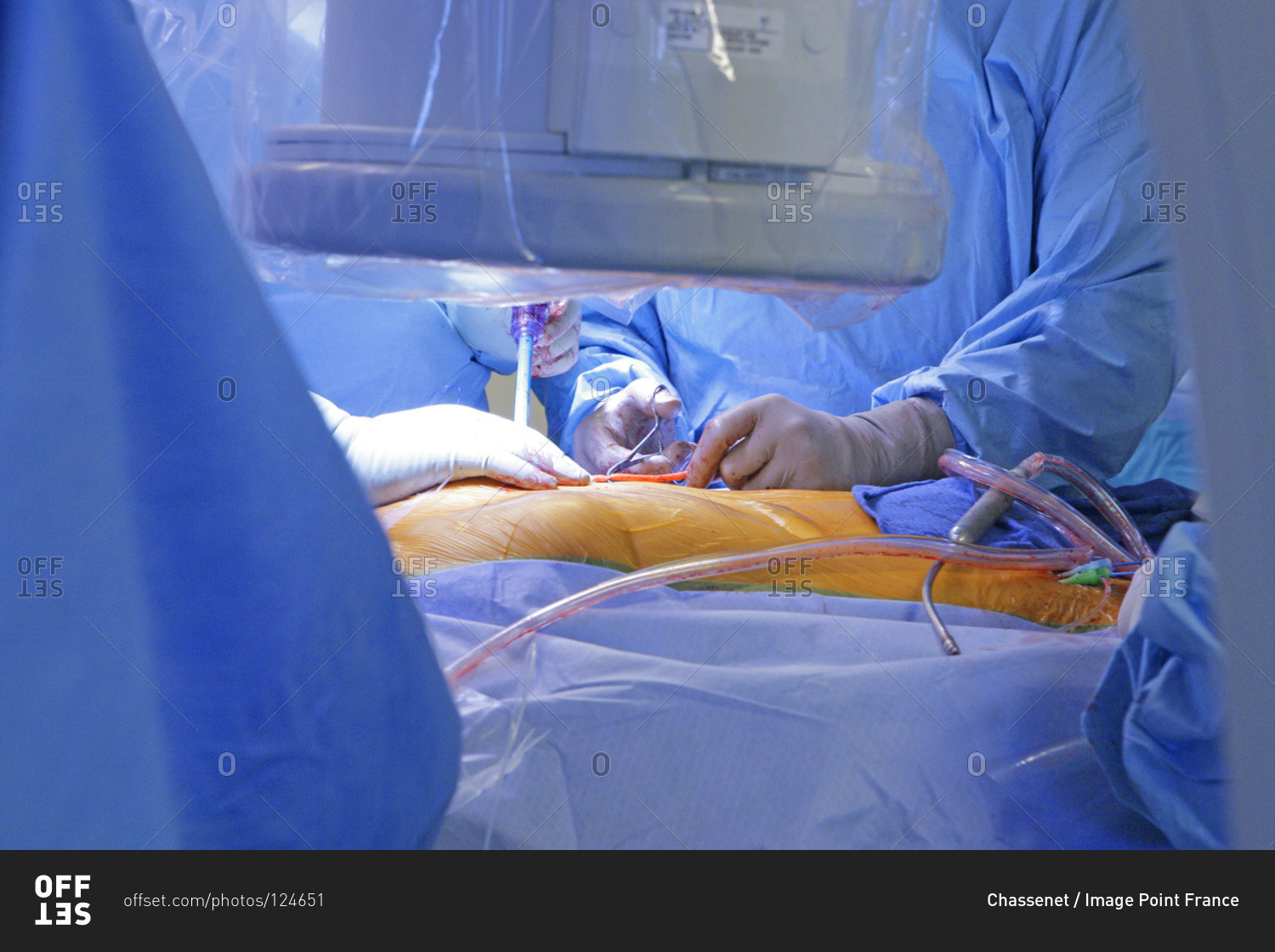 Surgeon performing a heart valve proth implantation.