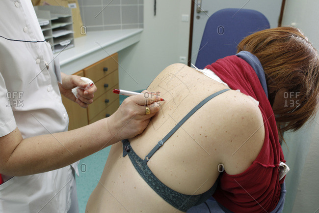 Woman undergoing an allergy test
