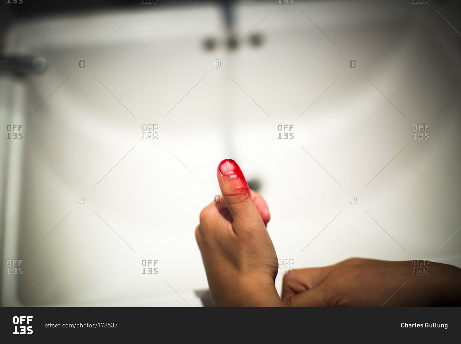 Close up of the bleeding thumb of a child