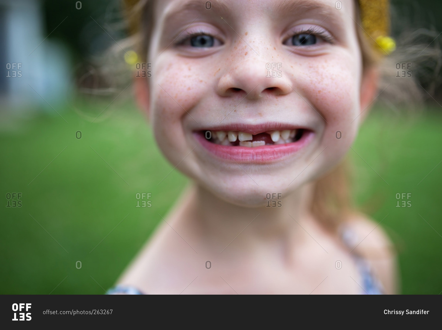 Girl with toothless smile