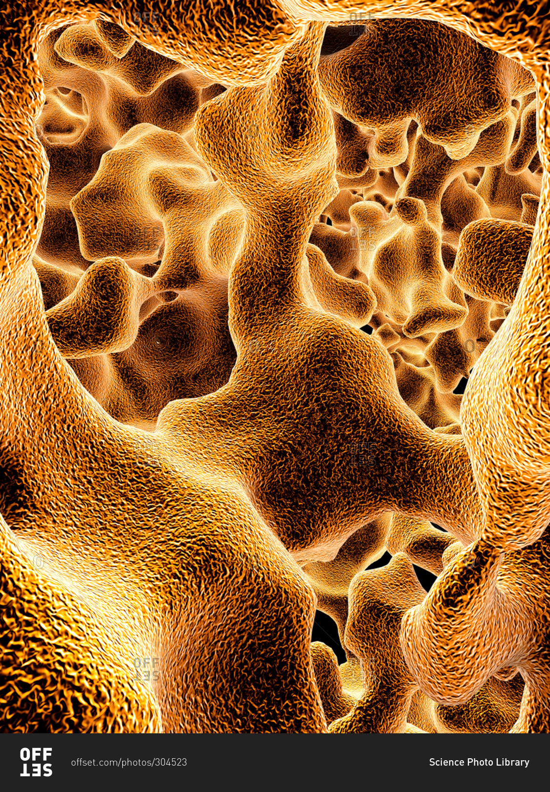 Illustration of the trabeculae in the cancellous (spongy) bone tissue