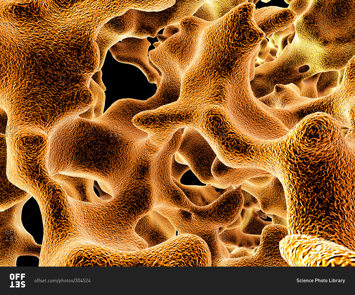 Illustration of the trabeculae in the cancellous (spongy) bone tissue