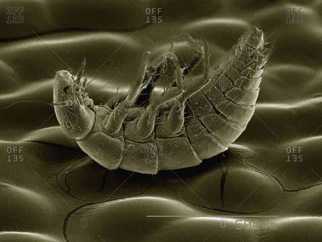 SEM of Triungulin larva of Meloid beetle (Meloidae)