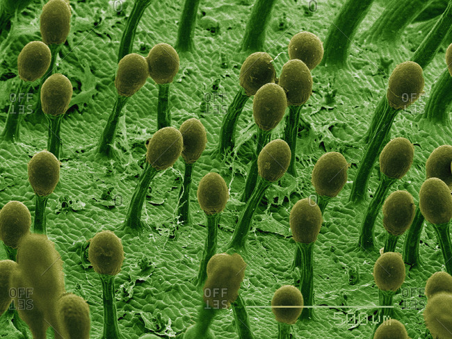 SEM of sticky hairs on sundew carnivorous plant
