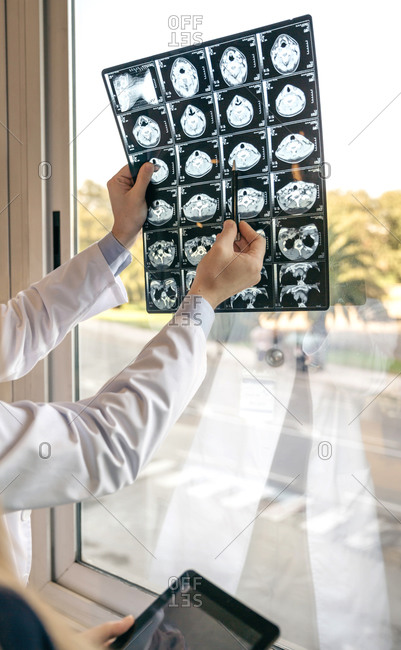 Two doctors discussing MRI scan at the window