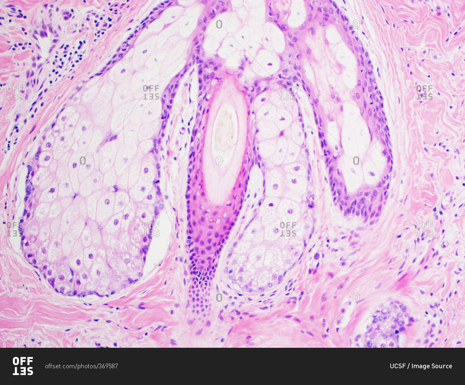 H&E stain, light microscopy, normal hair follicle stock photo OFFSET