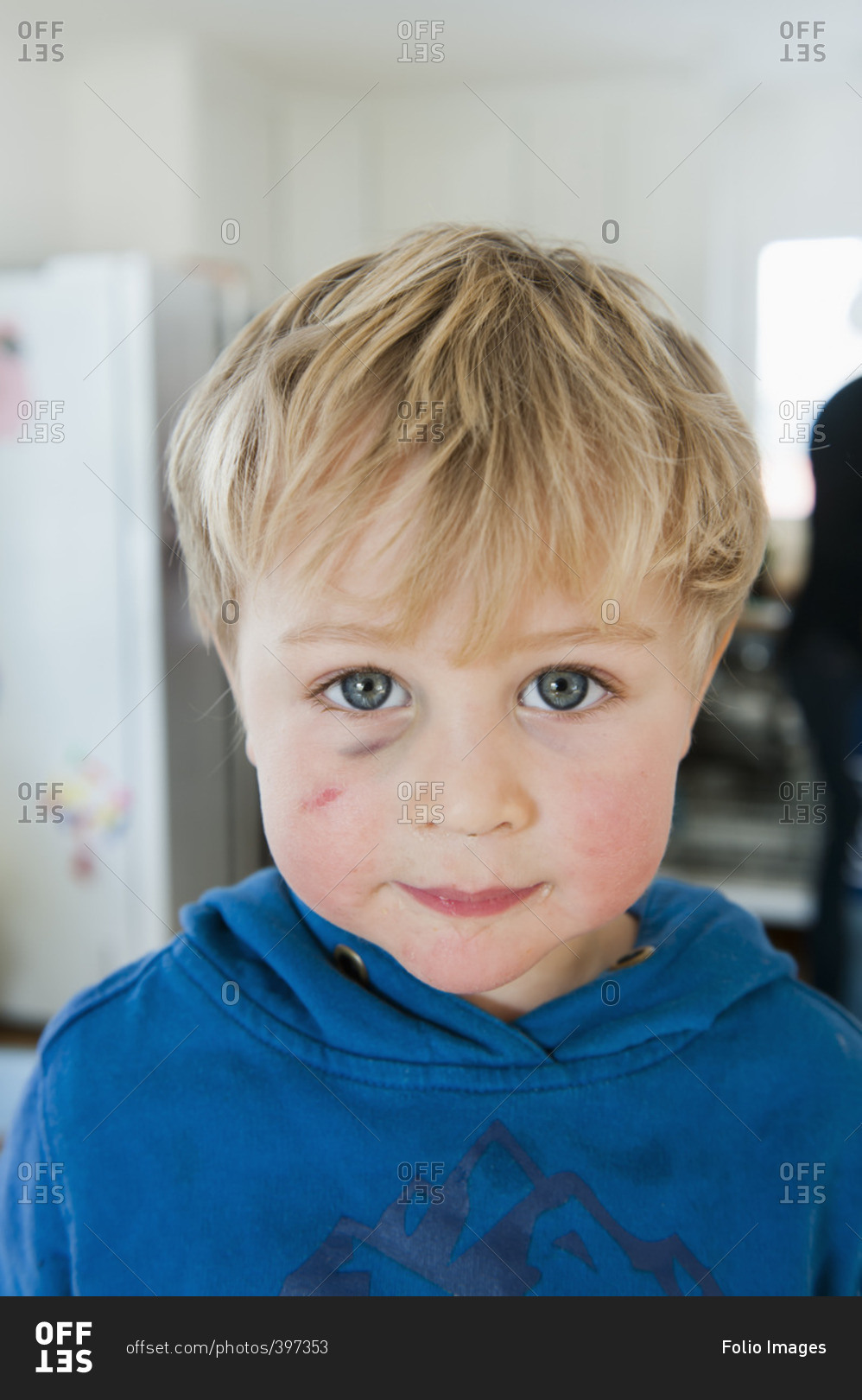 Sweden, Portrait of blonde little boy with black eye stock photo - OFFSET