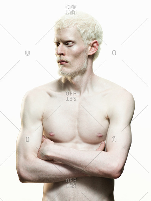 Naked Albino Men