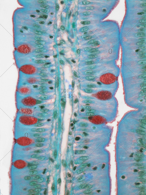 Light micrograph of a section through the finger-like projections (villi) of the duodenum, the uppermost part of the small intestine