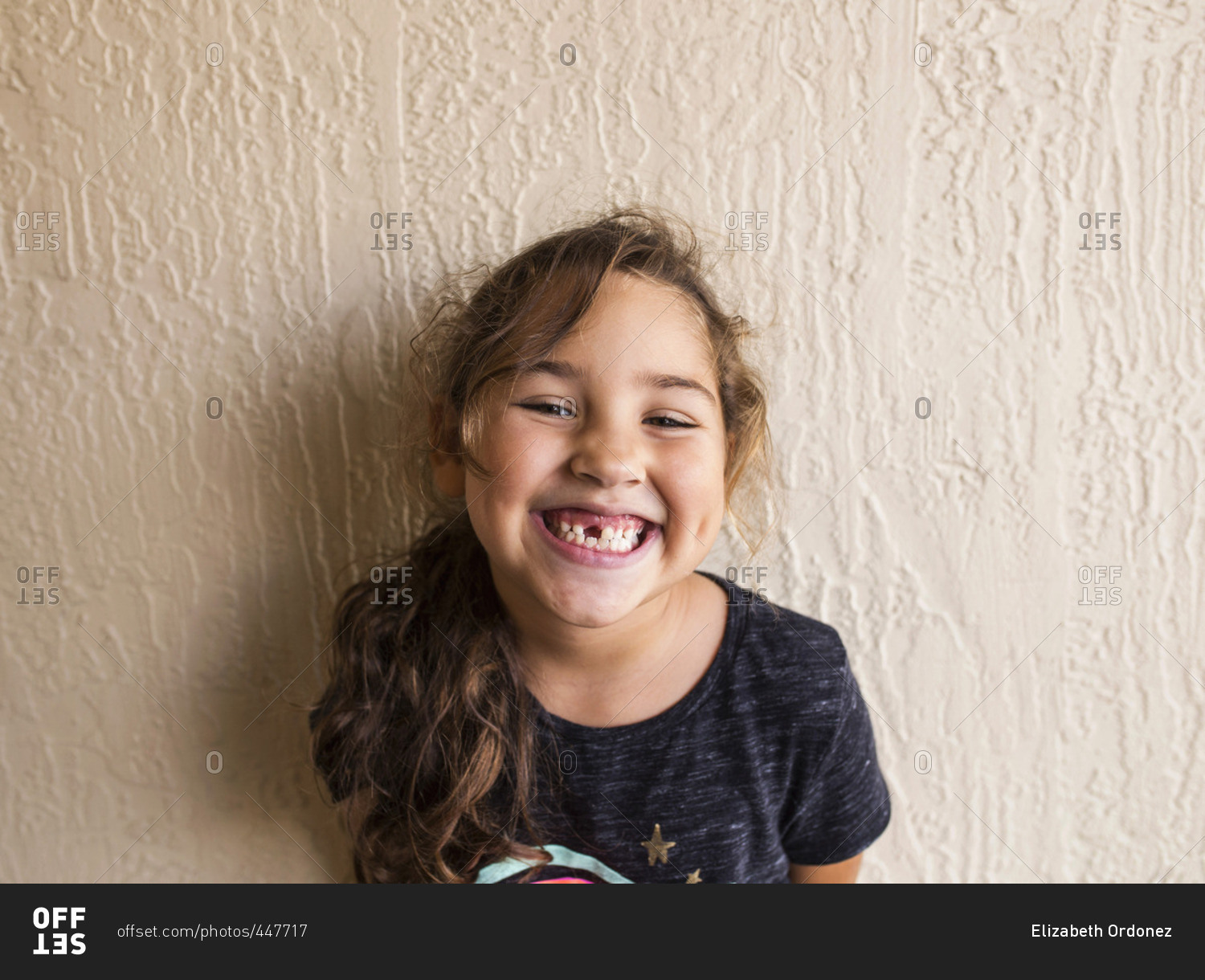 Portrait of a smiling girl with a missing front tooth stock photo - OFFSET