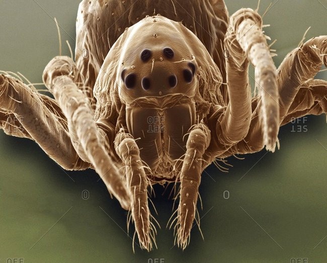 Baby spider, SEM