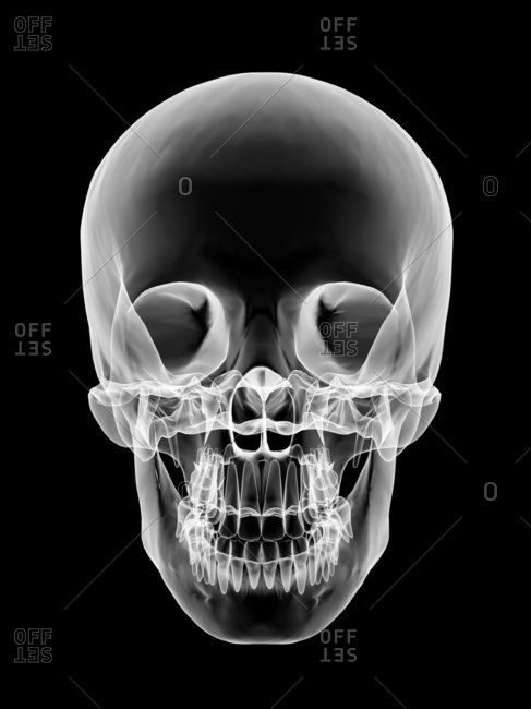Human skull, X-ray artwork - Offset