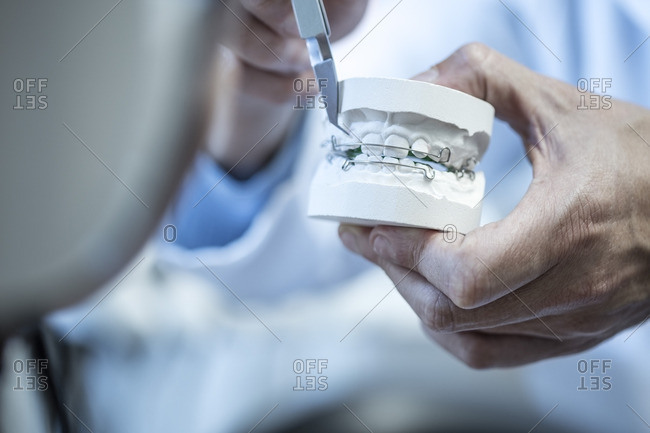 Orthodontist holding dental mold with braces