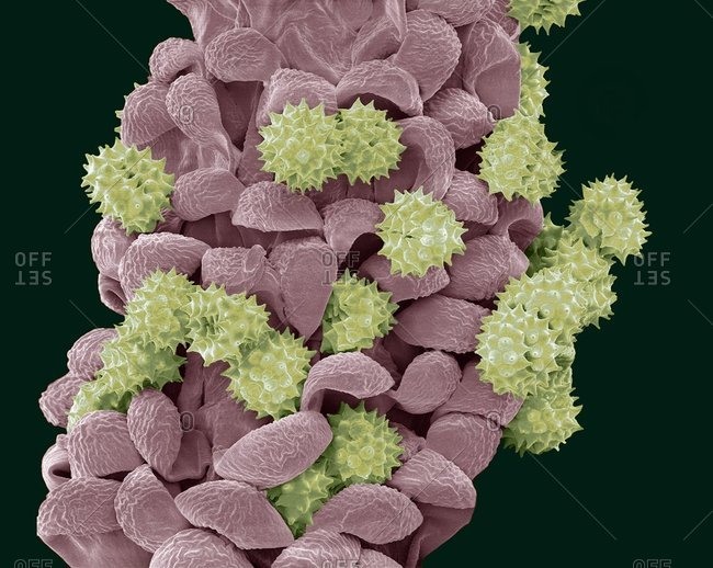 Daisy anther colored scanning electron micrograph (SEM) of pollen grains (yellow) on the anther of a common daisy (Bellis perennis)