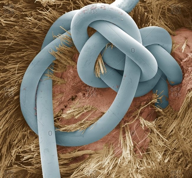 Sutured wound colored scanning electron micrograph (SEM) of a suture in a dog's skin wound